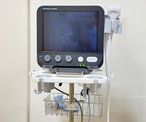 超音波診断装置